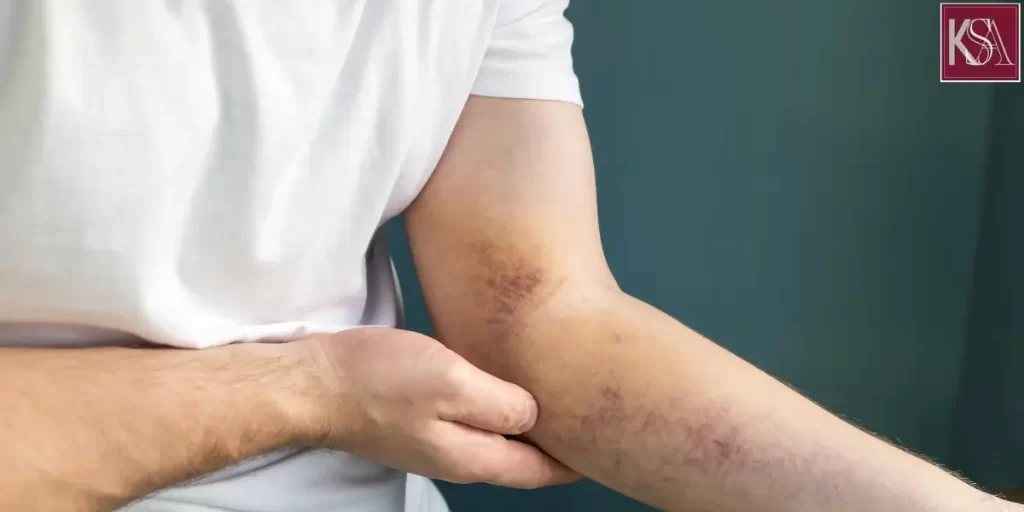 hire best san bernardino crushed hand work injury lawyer hire best san bernardino crushed hand work injury lawyer